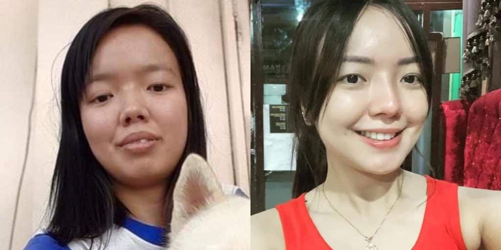 Rosmar Tan admits that she enhanced her appearance by the help of science